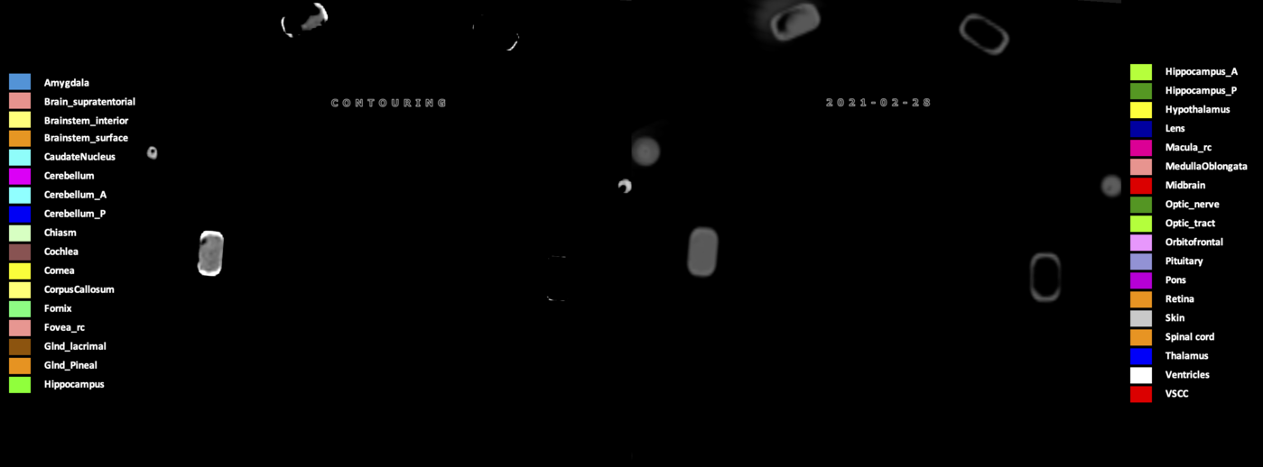Z=-10.62