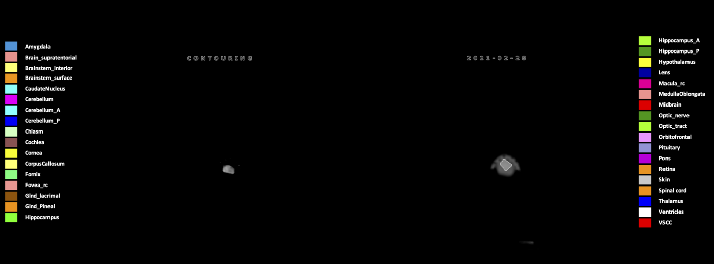 Z=12.98