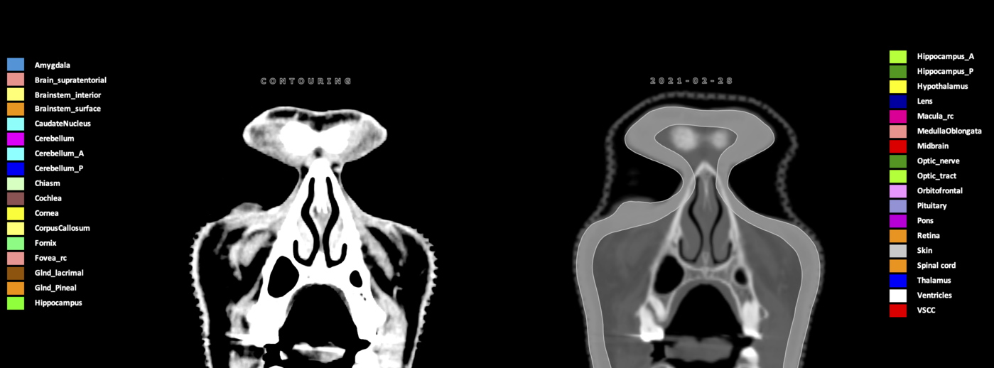 Z=8.68