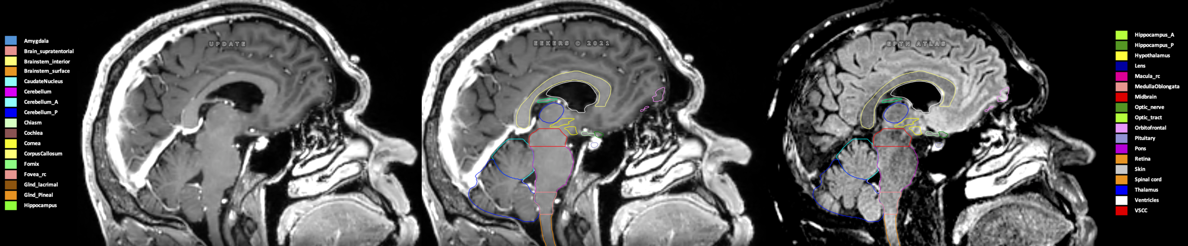 X=-0.36