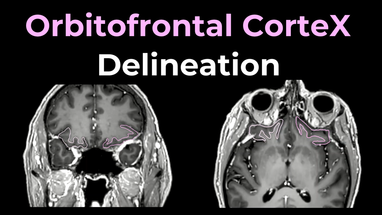 Orbitofrontal Cortex